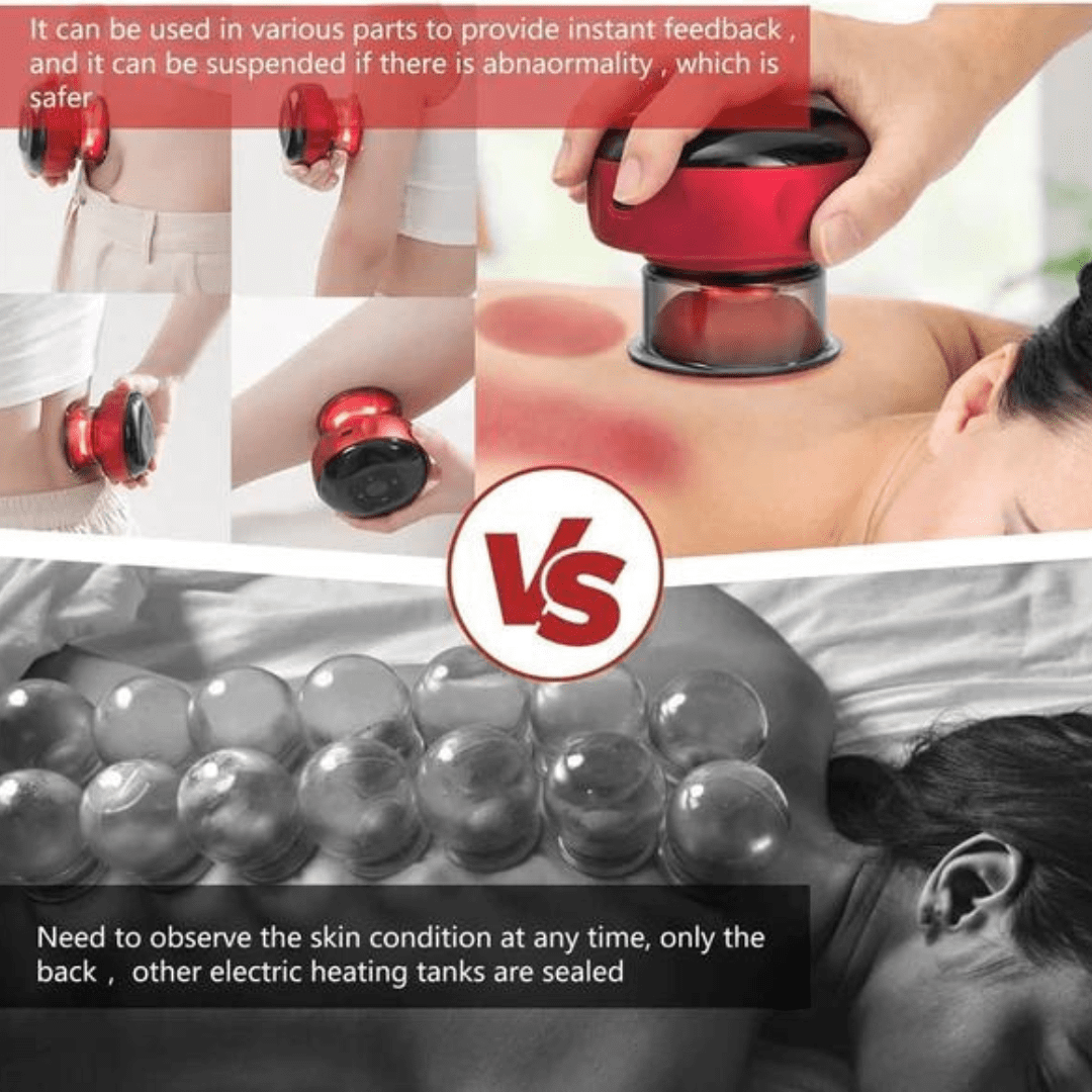 Smart Vacuum Cupping Massage (2)