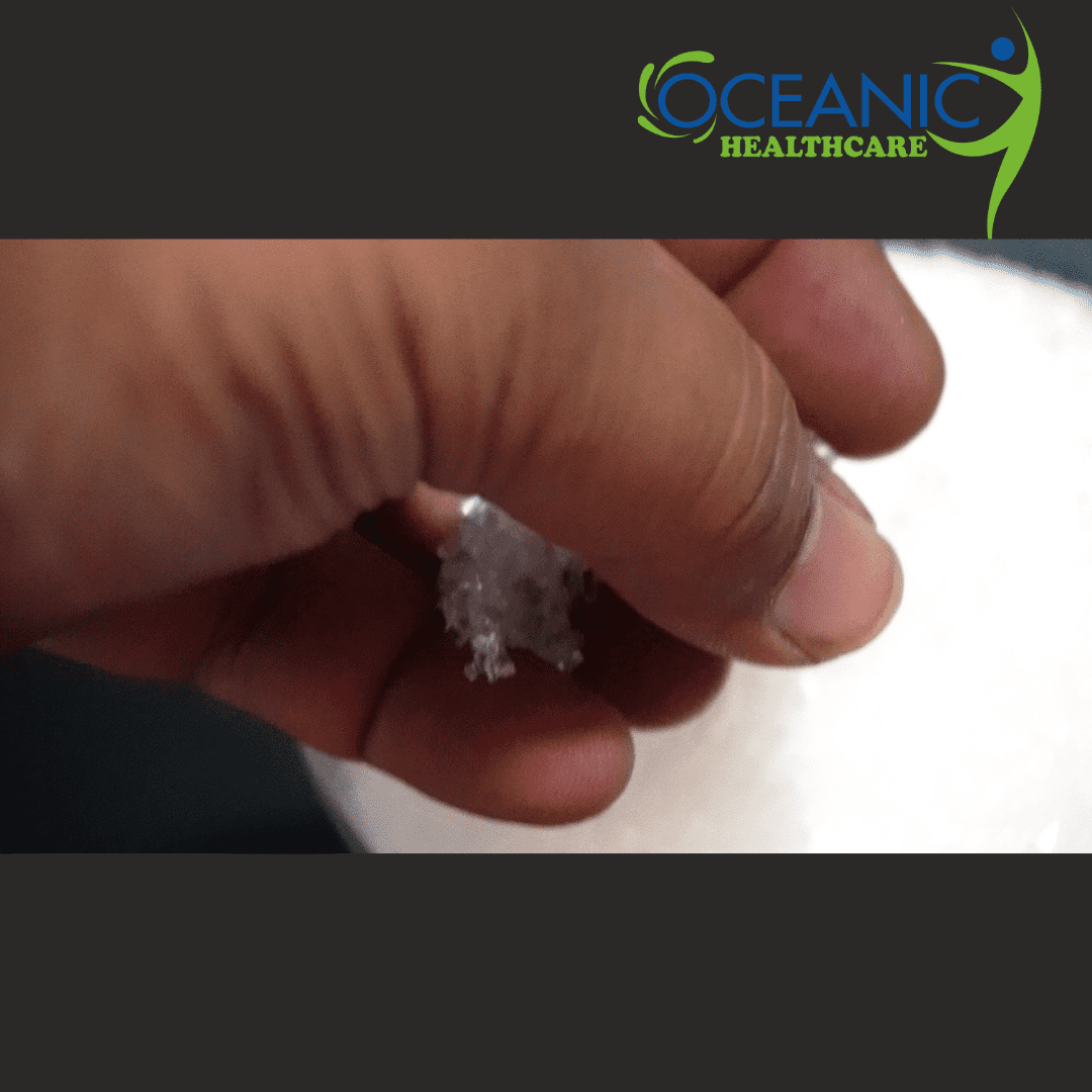 epsom salt magnesium sulphate (6)